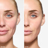 before and after
