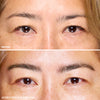 before and after