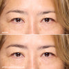 Side-by-side comparison showing the eye area before and after using a cosmetic product for three weeks, highlighting reduced appearance of fine lines and improved skin texture.