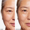 Visible improvement in skin texture and appearance after 16 days of product use, showcasing reduced discoloration and increased smoothness.
