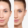 Before and After