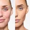 Before and After  