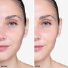 Side-by-side comparison showing a woman's face with visible skin improvement, highlighting enhanced smoothness and radiance after treatment.