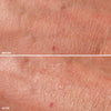 Before-and-after comparison of skin texture and appearance, highlighting reduced redness and improved smoothness.