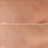 Comparison of skin texture improvement, showing a visibly smoother and more hydrated appearance after treatment.